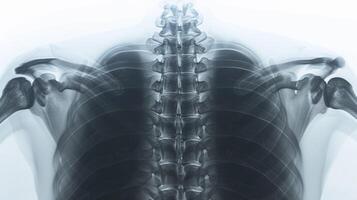 AI generated Thoracic spine radiography with rib articulations and costotransverse joints. photo