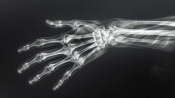 ai generado detallado radiografía de mano esqueleto con multa complejidades de el falanges, metacarpianos, y de mano huesos. foto