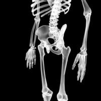 X-ray Vision,of the Human Body and Bones. photo