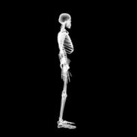 X-ray Vision,of the Human Body and Bones. photo