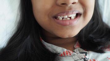 détail coup de enfant avec les dents disparu video