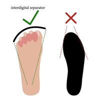 Interdigital separator, toe corrector, silicone Used for calluses and corns, finger deformities, arthrosis, arthritis, gout, vascular disorders, pain in the finger joints. Vector illustration