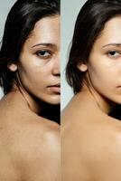 antes de y después cosmético operación. foto