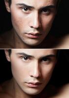 Before and after cosmetic operation. Young man portrait photo