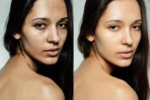 Before and after cosmetic operation. photo