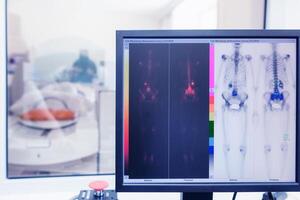 isótopo estudiar en el laboratorio de calculado tomografía. radioactivo estudiar en el detección de hueso cáncer foto