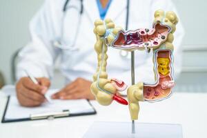 Intestine, appendix and digestive system, doctor holding anatomy model for study diagnosis and treatment in hospital. photo