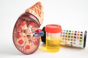 Urinalysis, Kidney model and urine cup with reagent strip pH paper test and comparison chart in laboratory. photo