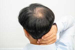 calvo en la cabeza media y sin pérdida de cabello glabro de hombre de oficina activo inteligente de negocios asiáticos maduros. foto