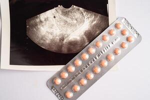 Birth control pills with ultrasound scan of baby uterus, contraception health and medicine. photo