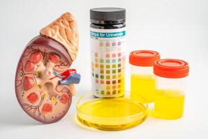 Urinalysis, Kidney model and urine cup with reagent strip pH paper test and comparison chart in laboratory. photo