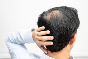 calvo en la cabeza media y sin pérdida de cabello glabro de hombre de oficina activo inteligente de negocios asiáticos maduros. foto