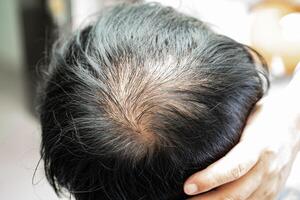 calvo en la cabeza media y sin pérdida de cabello glabro de hombre de oficina activo inteligente de negocios asiáticos maduros. foto