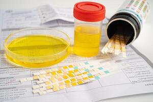 Urinalysis, urine cup with reagent strip pH paper test and comparison chart in laboratory. photo