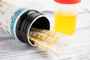 Urinalysis, urine cup with reagent strip pH paper test and comparison chart in laboratory. photo