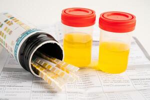 Urinalysis, urine cup with reagent strip pH paper test and comparison chart in laboratory. photo