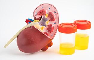 Urinalysis, Kidney model and urine cup with reagent strip pH paper test and comparison chart in laboratory. photo