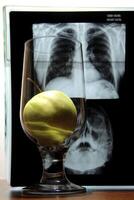 Medical symbols. Apple of knowledge in glass in front of x-ray radiography image of cortex analysis photo