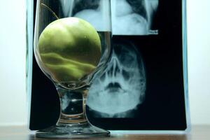 Health against diseases. Apple in clear glass over radiography image of brain disease x-ray analysis photo