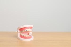 Orthodontic tooth model and bracket or brace. Clean and Scrape off tartar. May Orthodontic Health Day, March Oral health, Dentist Day, False Teeth. Toothache and Children Dental Health photo