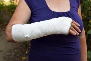 Woman with a broken arm outdoors. The arm is covered with plaster. photo