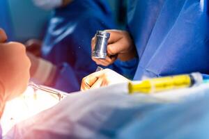 profesional doctores en médico uniforme haciendo un operación. proceso de operación por neurocirujanos. de cerca. foto