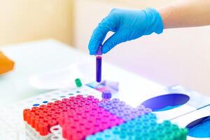 Blood sample. Lab technician holding blood tube sample for study photo