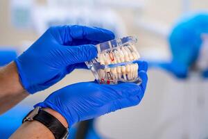 Doctor shows on a plastic jaw sample or model different methods photo