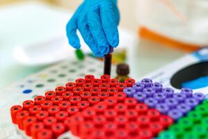 Laboratory worker puts tube with blood on a special rack with many colorful vials. A lot of test tubes with blood samples with colored lids on the rack and a hand of a lab technician adds one. photo