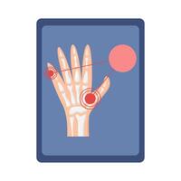 bone hand in board illustration vector