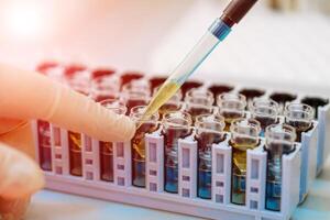 Scientist working with blood sample in laboratory photo