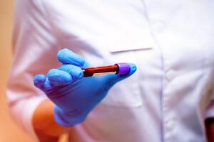 Hand of a doctor in blue gloves is holding a tube with blood sample. Biochemistry analysis at laboratory. Health care concept. Selective focus. photo