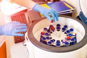 Female's hand in blue glove putting blood samples into a centrifuge in laboratory. photo