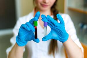 Blood sample. Lab technician holding blood tube sample for study photo