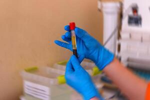 Science, medicine and virus concept. Young female scientist holding test tube with blood sample photo