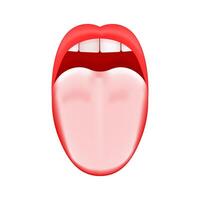 White or coated tongue. Dry mouth. Open human taste organ with symptoms of stomatitis, candidiasis or glossitis bacterial infection vector