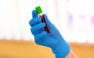 Hand in blue latex gloves holding blood sample vial in modern clinic background. Closeup. photo