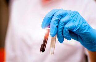 Hand of a doctor in blue gloves is holding a tube with blood sample. Biochemistry analysis at laboratory. Health care concept. Selective focus. photo