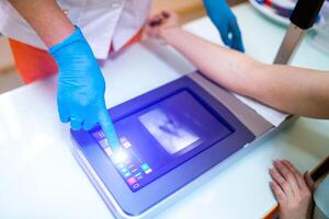 vena descubridor. enfermero toma un sangre muestra desde el paciente. moderno médico tecnología foto