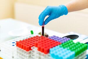 Female nurse puts blood samples in tubes onto a special rack on a table. Doctor's hands in blue latex gloves put the test tube in a rack with many colorful vials in a laboratory. Close-up. photo