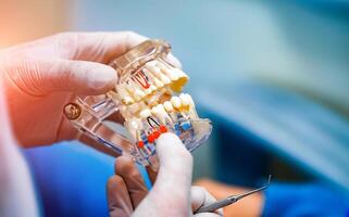 Doctor shows on a plastic jaw sample or model different methods of teeth treatment. Modern dental clinic background. Health concept. White medical gloves on male doctor's hands. photo