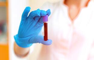 Vial full of blood in the hand of a laboratory specialist. Woman's hand in blue protective glove is holding a test tube with red liquid. Close-up. photo