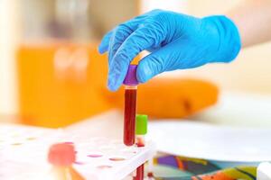 Hand in latex gloves of a laboratory worker is putting tube with blood on a rack. Blue protective glove of a female holds a vial with blood on the background of special tray on table. Close-up. photo