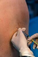 Medical hands in gloves doing injection patient. Female doctor with vaccine shot in hand. photo