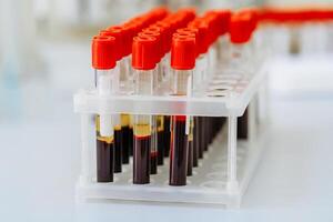 Many test tubes with blood being tested. Medical equipment photo