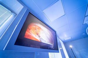 Medical devices, Interior hospital design concept. Interior of operating room in modern clinic, screen with tests. closeup photo