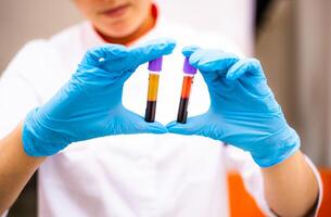 Medical technician holding Blood tube in Laboratory. Medical equipment photo