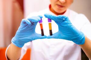 Doctor in blue gloves is holding two tubes with blood sample. Biochemistry analysis at laboratory. Health care concept. Selective focus. photo