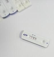 Rapid test kit for AFP or Alfa-fetoprotein testing, showing positive result, tumor or cancer marker for liver. photo