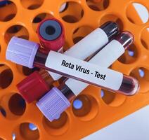 Blood sample for Rotavirus test. Scientist holding Rotavirus infected blood in test tube laboratory background. photo